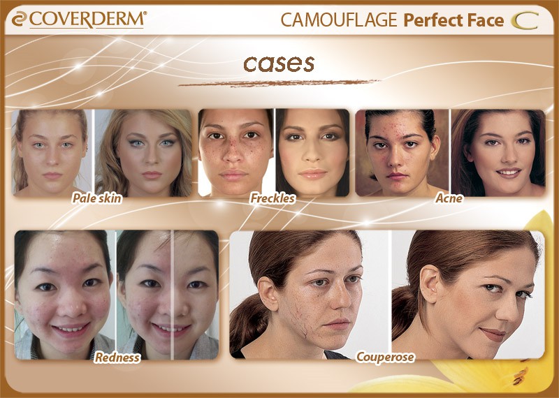 CVD052_Perfect face_cases copy