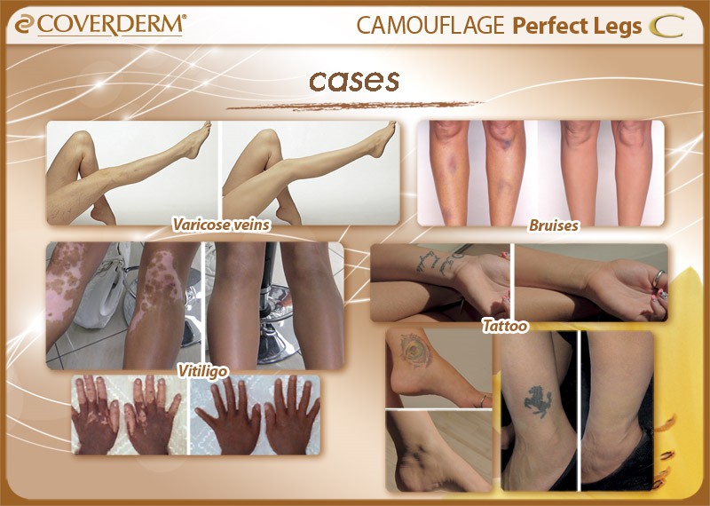 CVD072_Perfect legs+fluid_cases copy